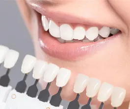 راهنمای کامل انواع کامپوزیت دندان + عکس
