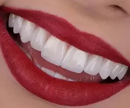 بهترین کلینیک زیبایی دندان تهران  